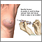 Biopsia con aguja del seno