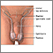 Reparación quirúrgica de la torsión testicular - serie