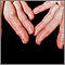 Amiloidosis de los dedos