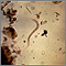 Anquilostoma larva rabditiforme