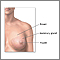 Extirpación del tumor de seno - serie - Anatomía normal