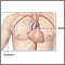 Arteriograma cardíaco