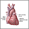 Arterias cardíacas anteriores