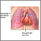 Hipertensión pulmonar primaria