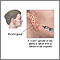 Biopsia de glándula salival